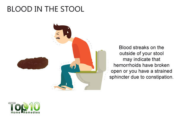 Blood In The Stool N 600x400