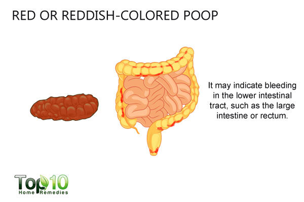 Red Or Reddish Colored Poop 600x400