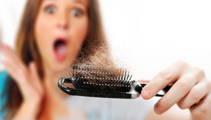 Healthseborrheic Dermatitis Hair Loss