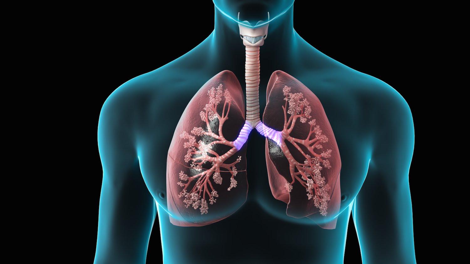 Lung