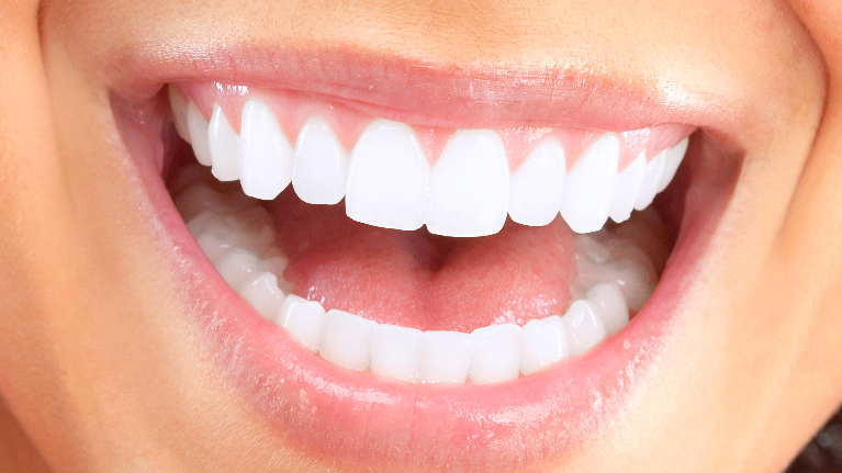 Medium_Kick Off The New Year With Teeth Whitening