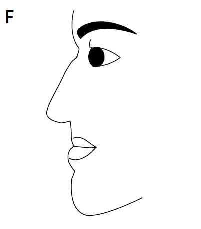 Protruding Lower Lip