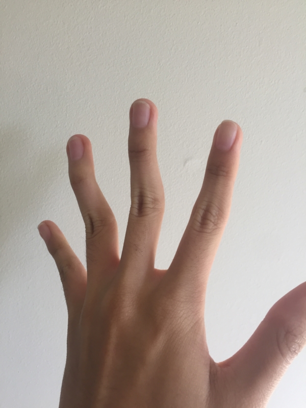 ១