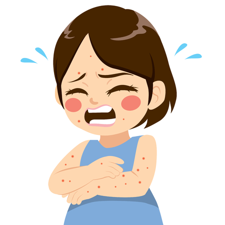 102695253 Stock Vector Cute Little Girl With Small Itchy Blisters Symptom Ill With Measles Chickenpox Illness