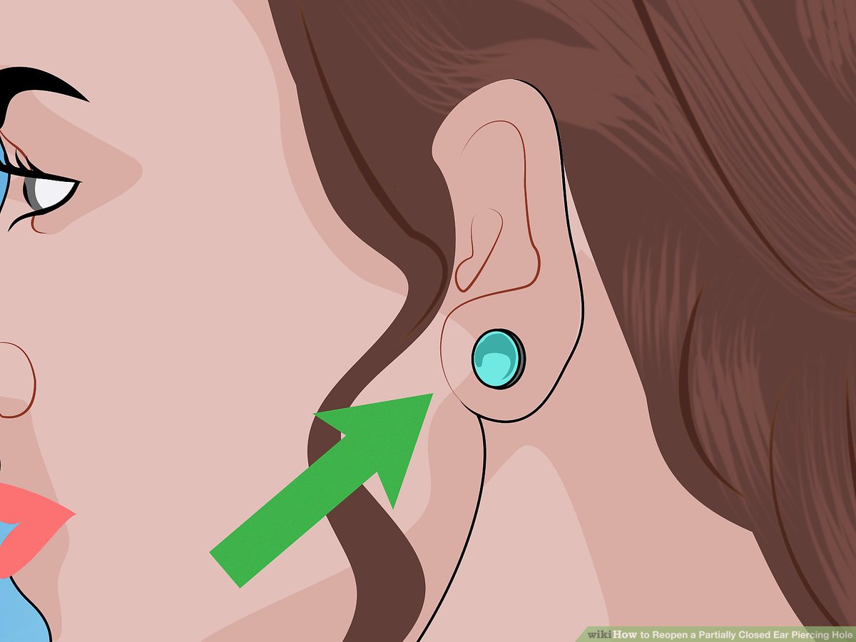 Aid4140310 V4 1200px Reopen A Partially Closed Ear Piercing Hole Step 17 Version 2