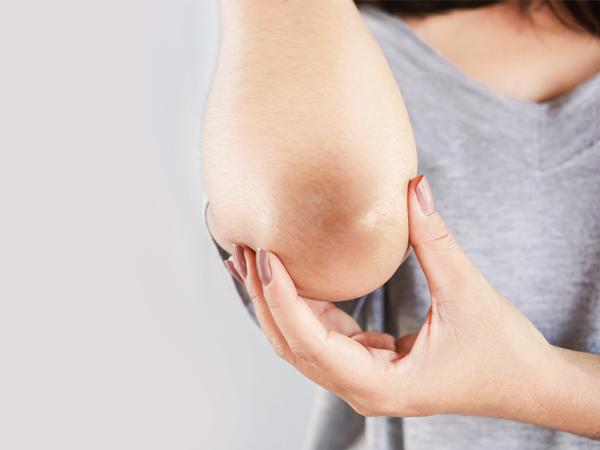 Dark Underarms Are Normal_4_5f118bd9066bf