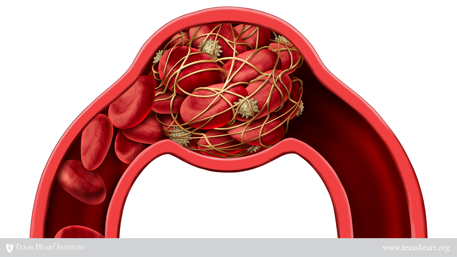 Blood Clot Disease Symbol