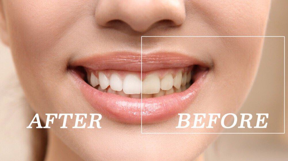 Coconut Oil To Look Younger