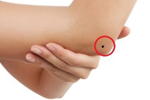 Mole On Elbow