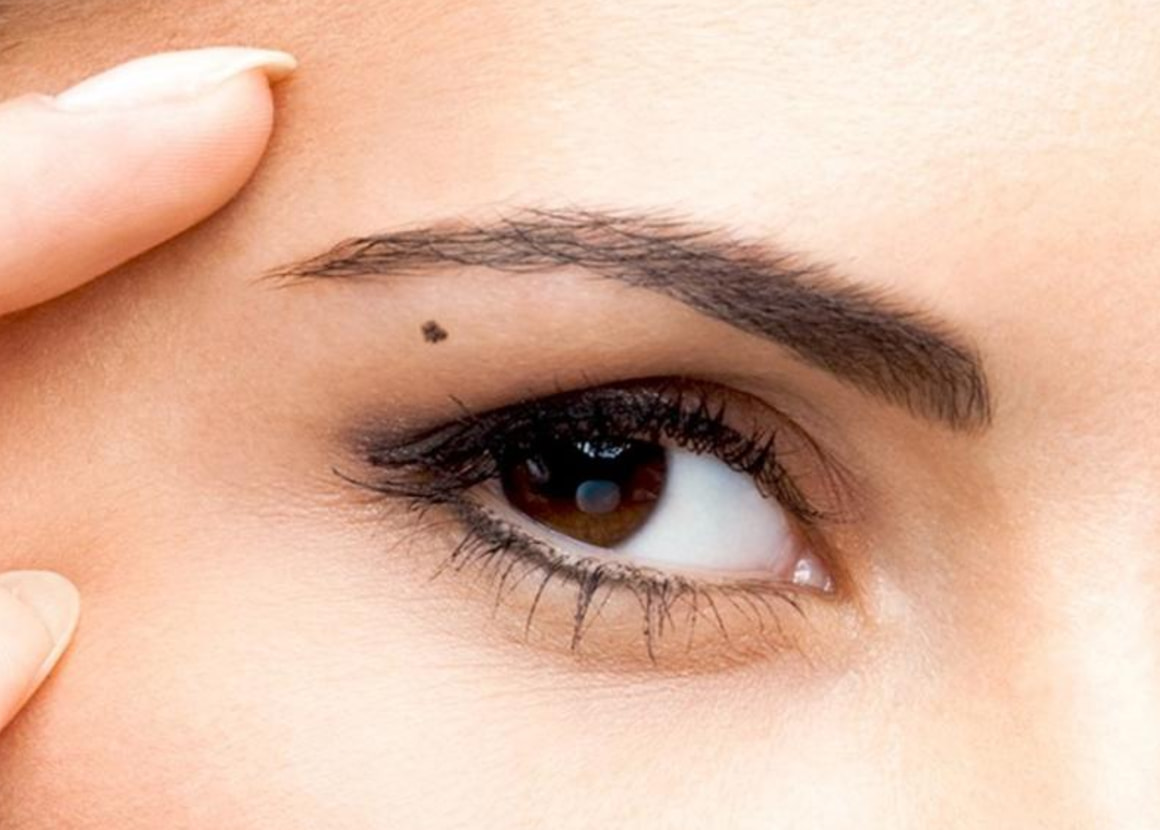 Mole Under Eyebrows