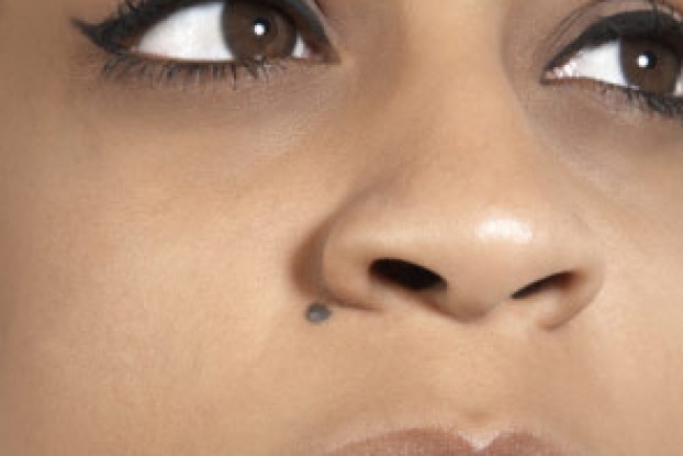 Skin Moles 1 622x415