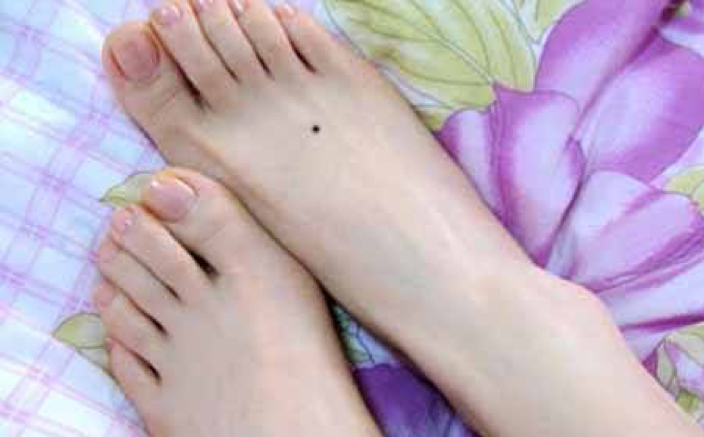 ៦