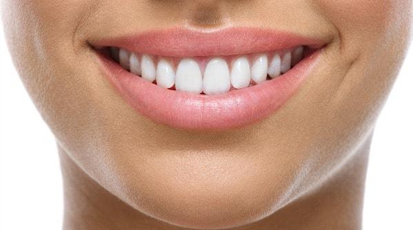 Lip_Lines_1_e124d977 9a5f 4f33 A4b2 Bb88c5f903f2