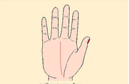 Hand1