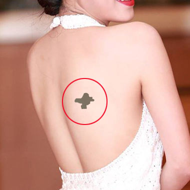 4 Vi Tri Xuat Hien Vet Bot Bao Hieu Nguoi Co So Thien Kim 14d035
