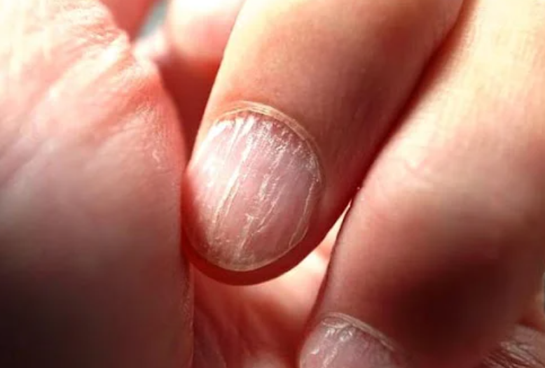 Ice_screenshot_20211201 230212