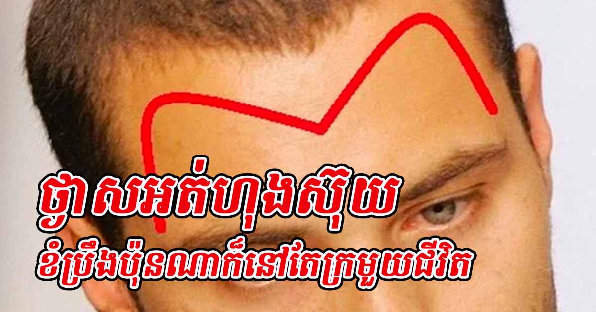ថ្ងាស ៤ ប្រភេទ បង្ហាញថា ខ្សែជីវិតអ្នកមិនល្អទេ ក្រក្រីមួយជីវិត តែបើមាន២ប្រភេទនេះ ល្អខ្លាំង