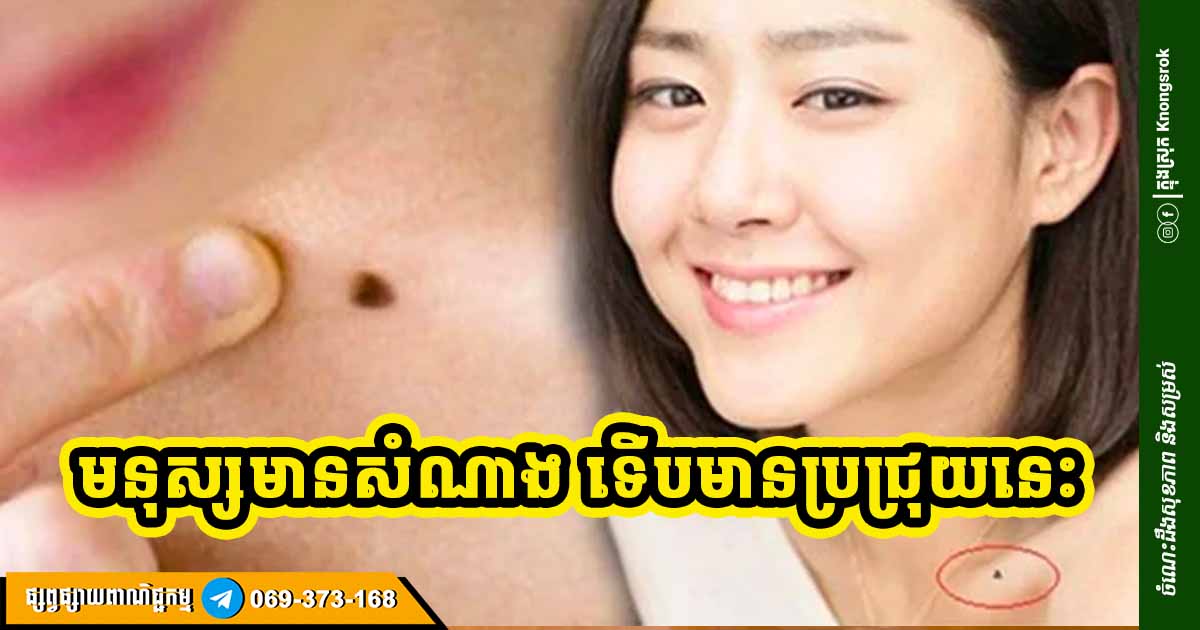 អ្នកមានប្រជ្រុយ ១ ក្នុងចំណោម ៦ នេះ មានសំណាងច្រើនជាងគេនៅក្នុងជីវិត អ្នកមានប្រជ្រុយ ១ ក្នុងចំណោម ៦ នេះ មានសំណាងច្រើនជាងគេនៅក្នុងជីវិត