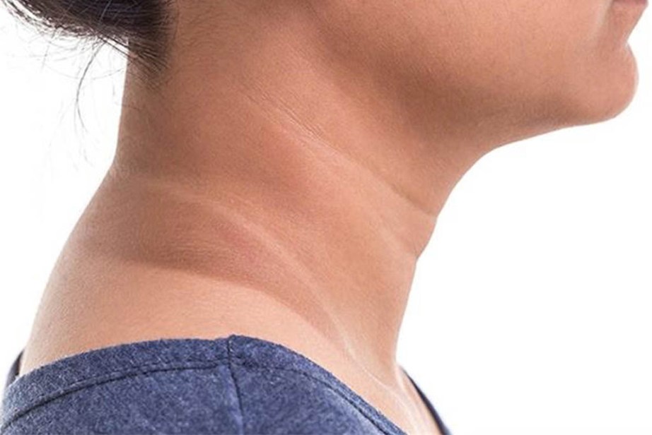 Black Neck 1