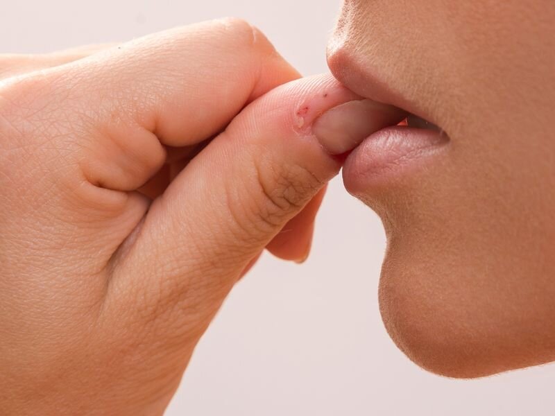 Bite Your Nails Or Pic