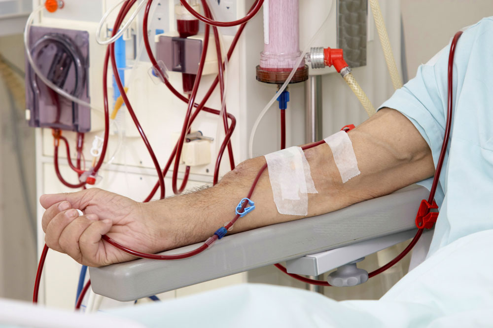 Dialysis Treatment
